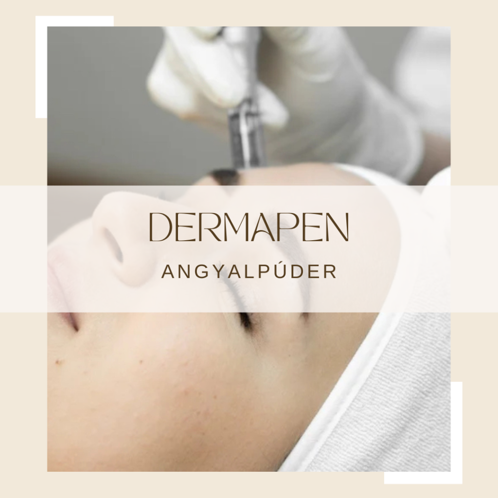 Dermapen - AngyalPúder Szépségszalon